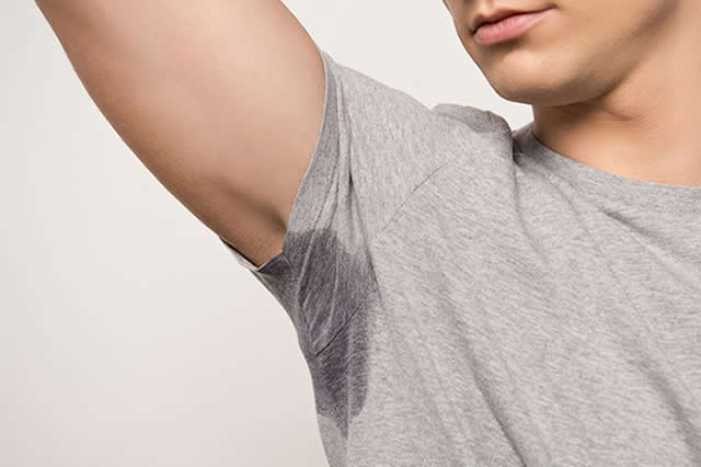 HIPERHIDROSIS EN QUITO